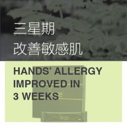 Serious Hands' Allergy Improved in Just 3 Weeks
