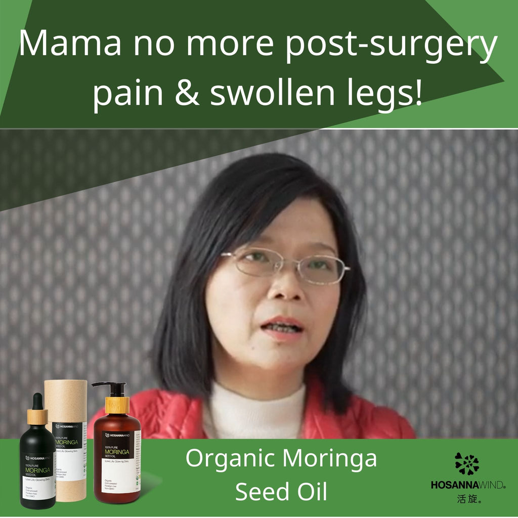 Mama No more post-surgery pain and swollen leg