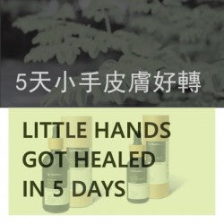 Little hand got healed in 5 days