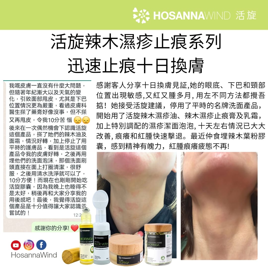 HOSANNAWIND MORINGA ECZEMA CREAM