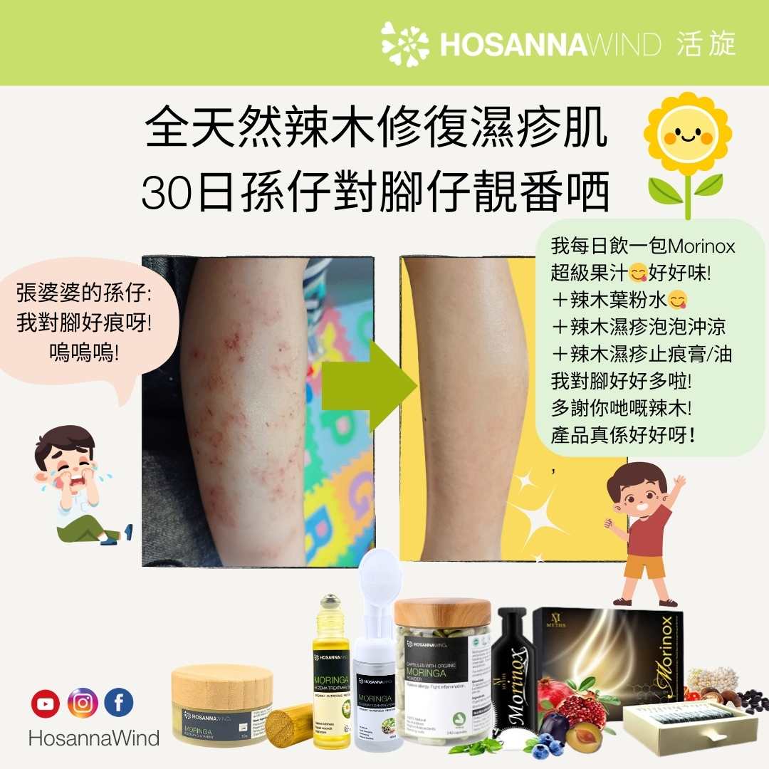 HOSANNAWIND MORINGA BABY BODY CARE SET (FIT FOR SENSITIVE SKIN AND ECZEMA)