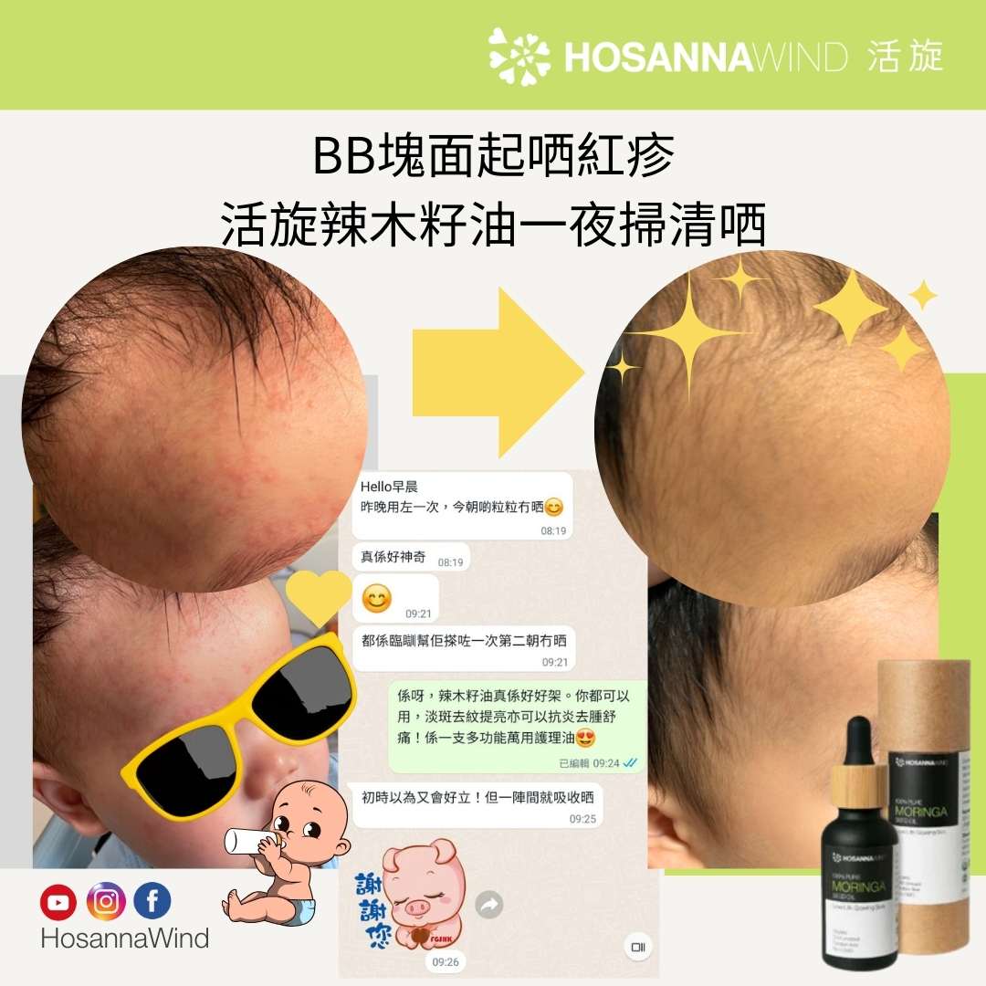 HOSANNAWIND MORINGA ECZEMA CARE TRIAL SET