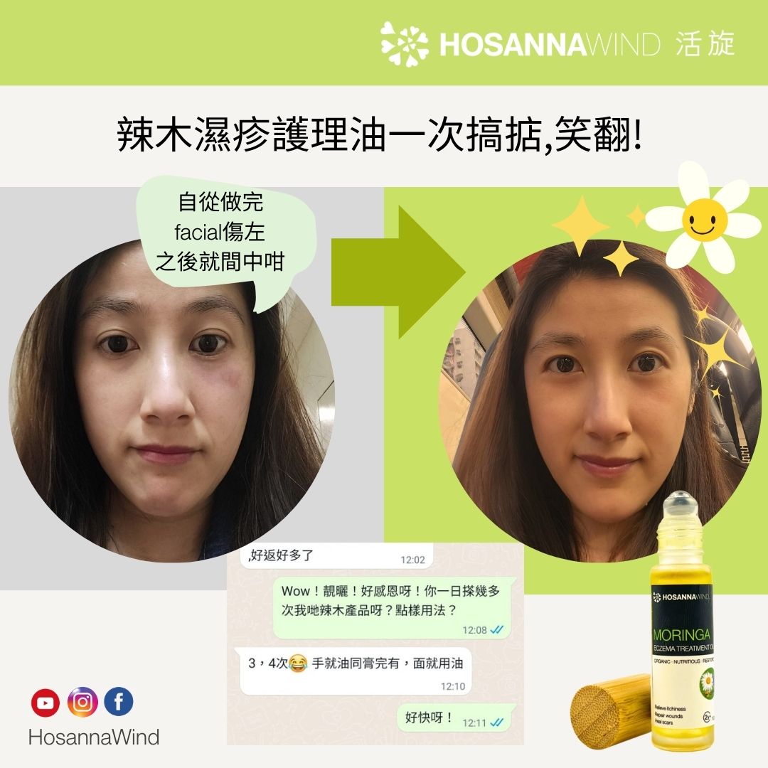 HOSANNAWIND ECZEMA TREATMENT OIL