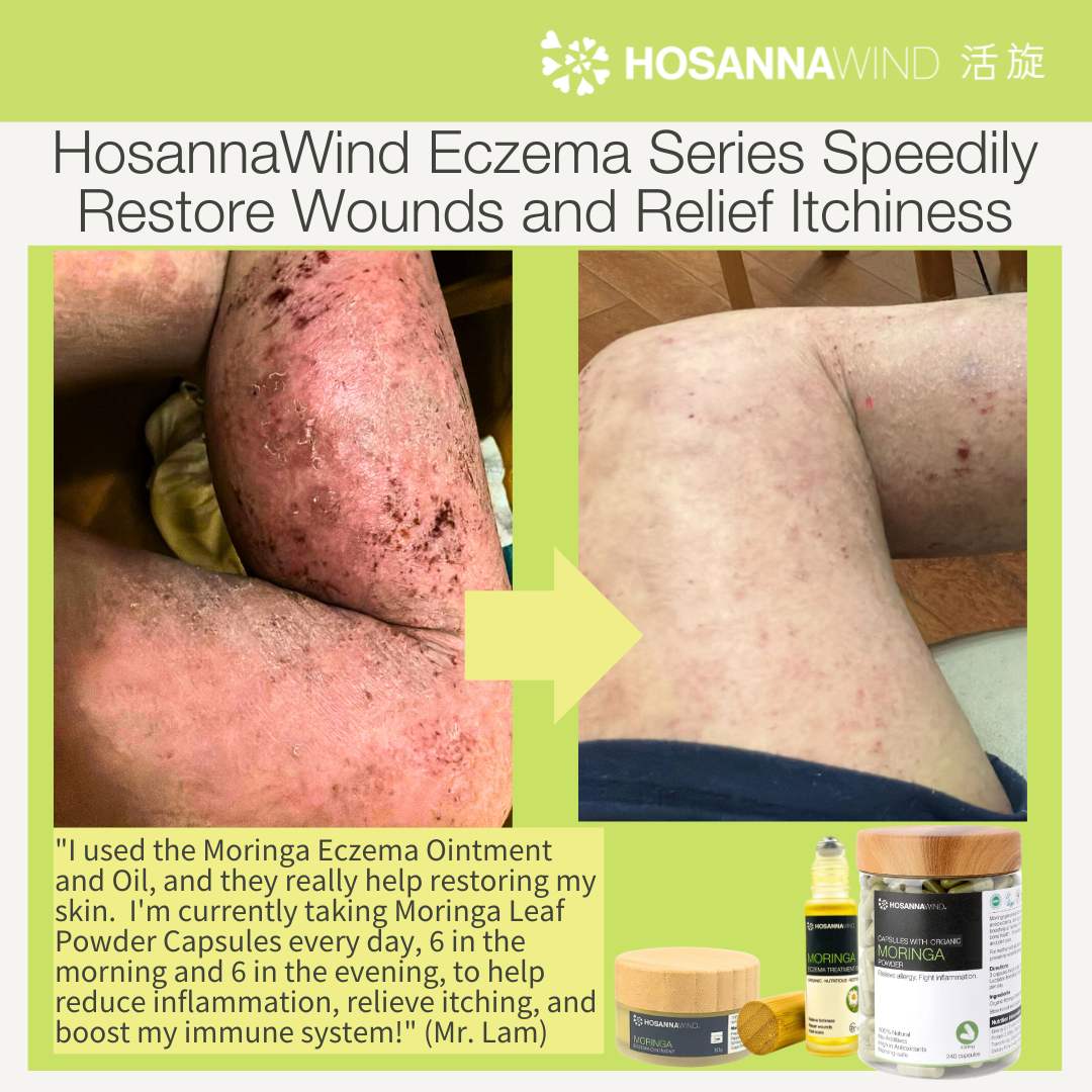 HOSANNAWIND MORINGA SEED OIL 15mL