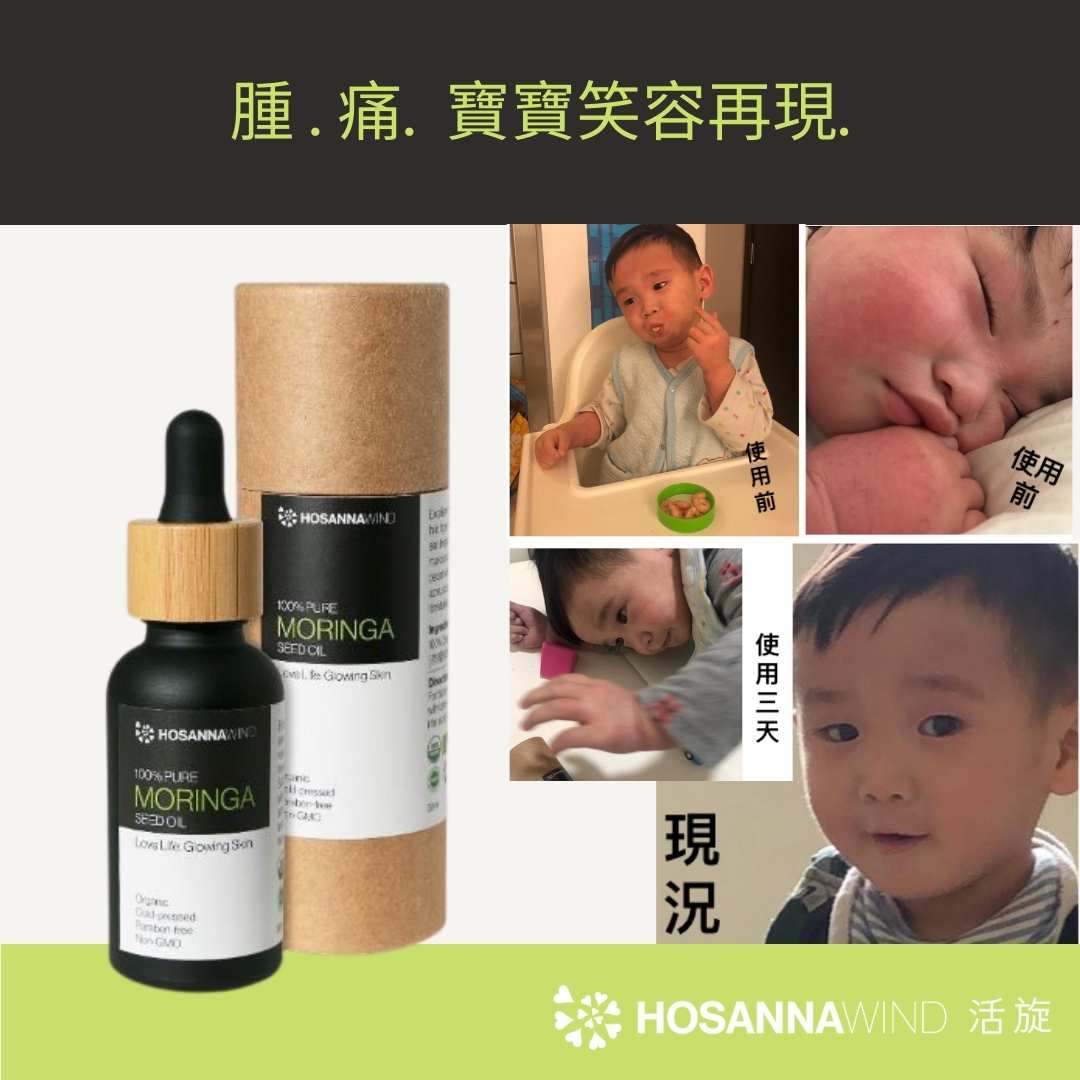 HOSANNAWIND MORINGA ECZEMA CARE TRIAL SET