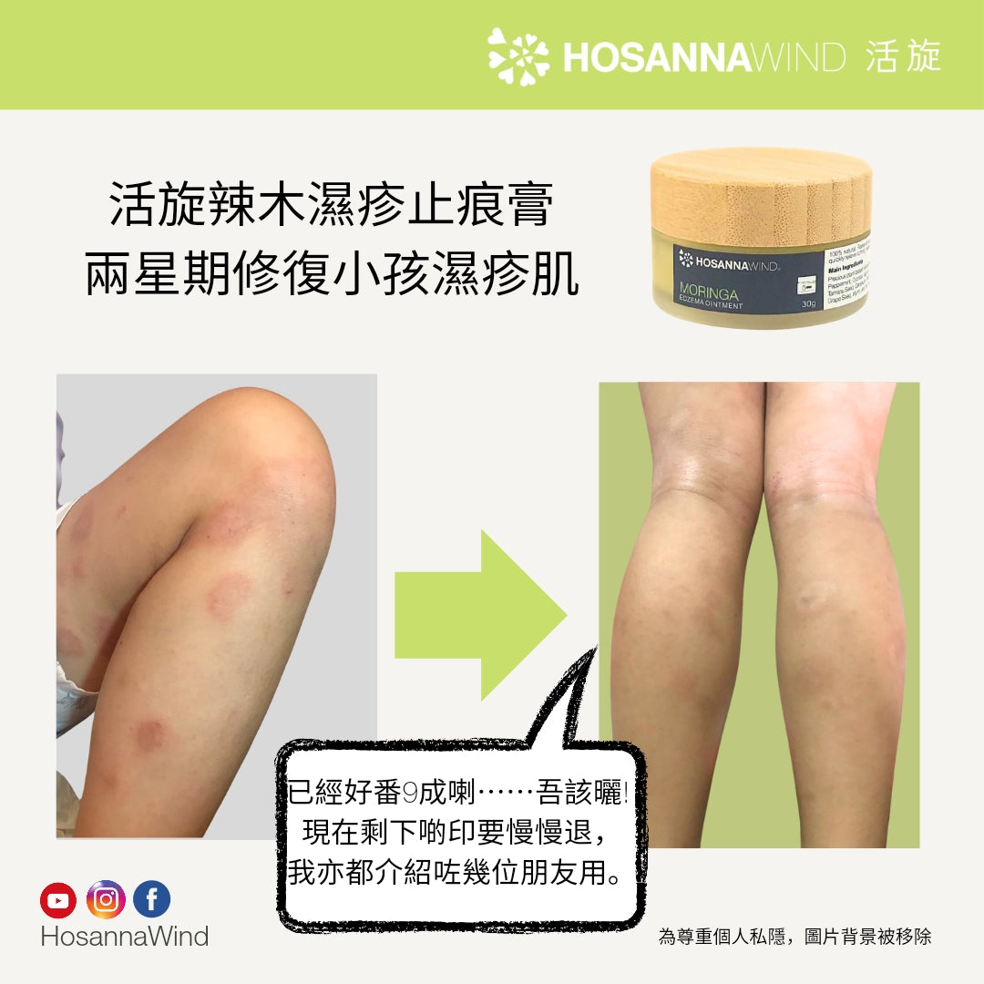 HOSANNAWIND MORINGA ECZEMA OINTMENT