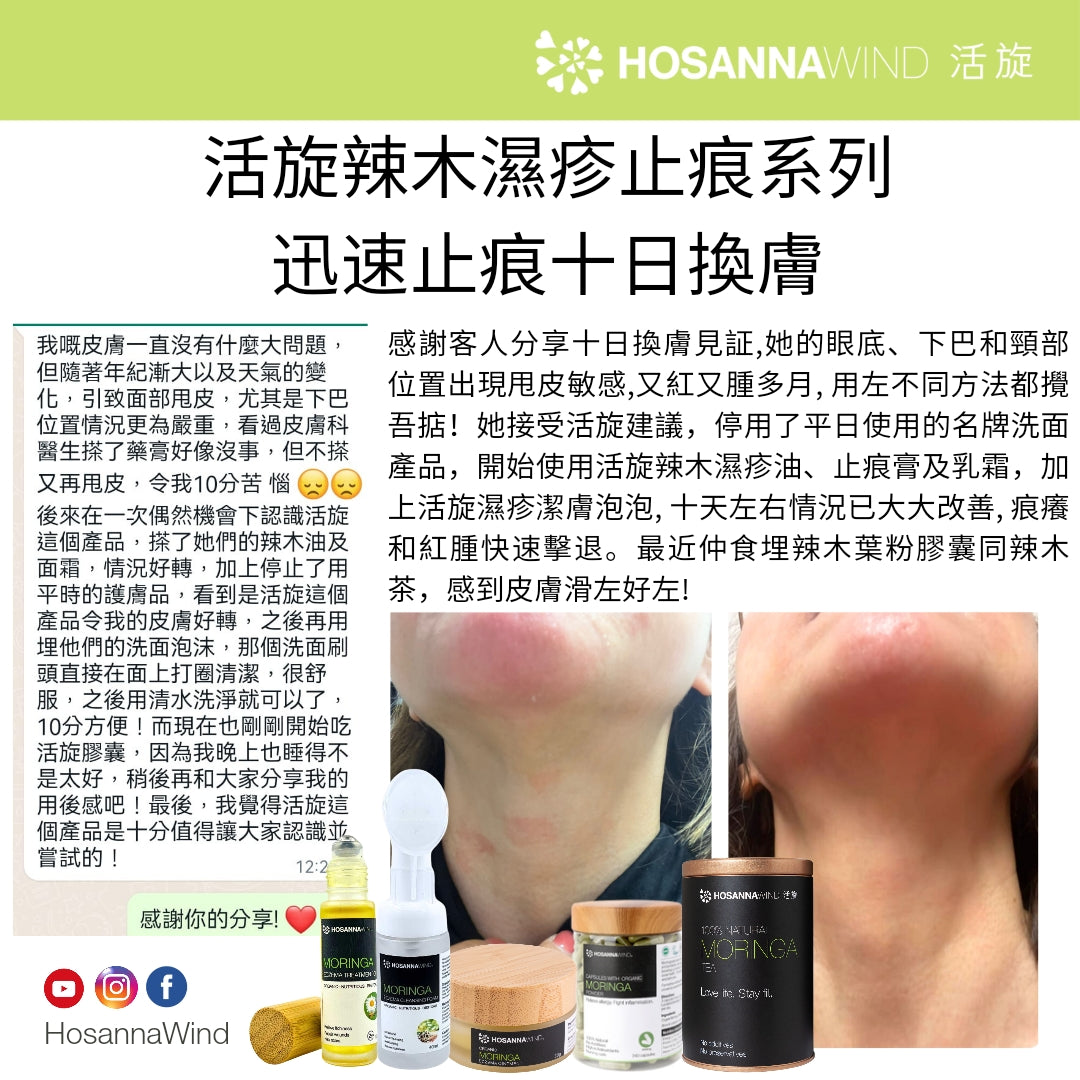 HOSANNAWIND MORINGA ECZEMA CARE TRIAL SET