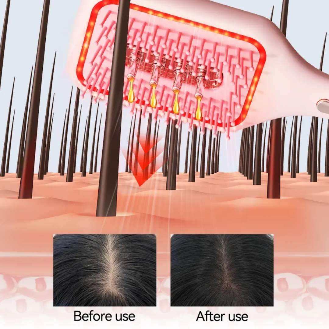 HOSANNAWIND SCALP THERAPY AND HAIR GROWTH COMB