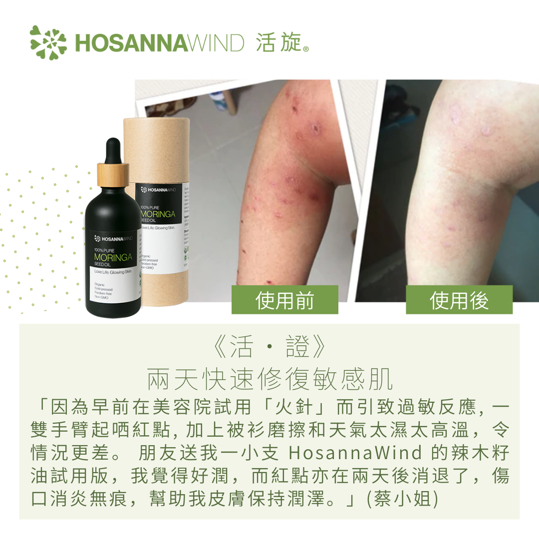 HOSANNAWIND MORINGA SEED OIL 3mL