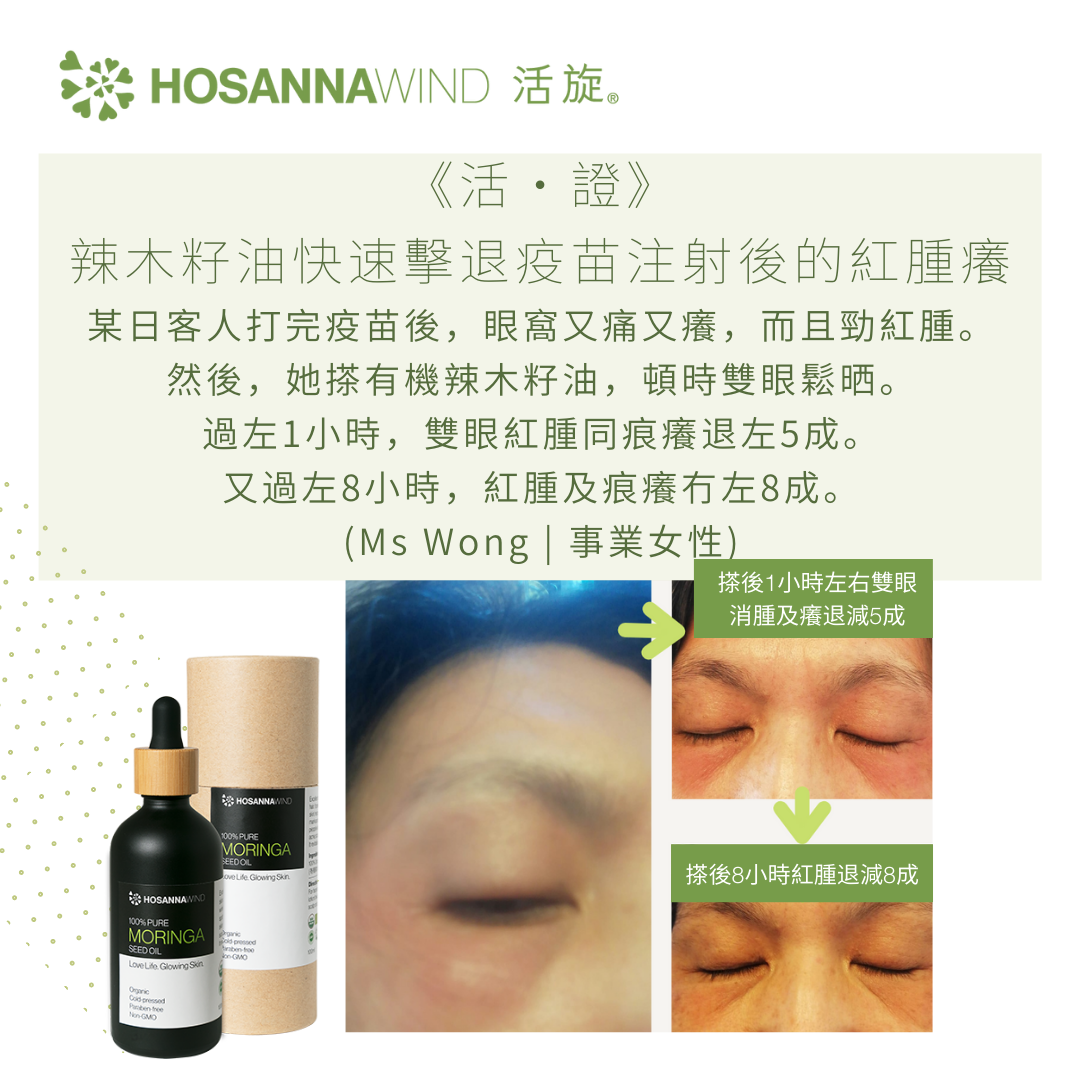 HOSANNAWIND MORINGA SEED OIL 15mL