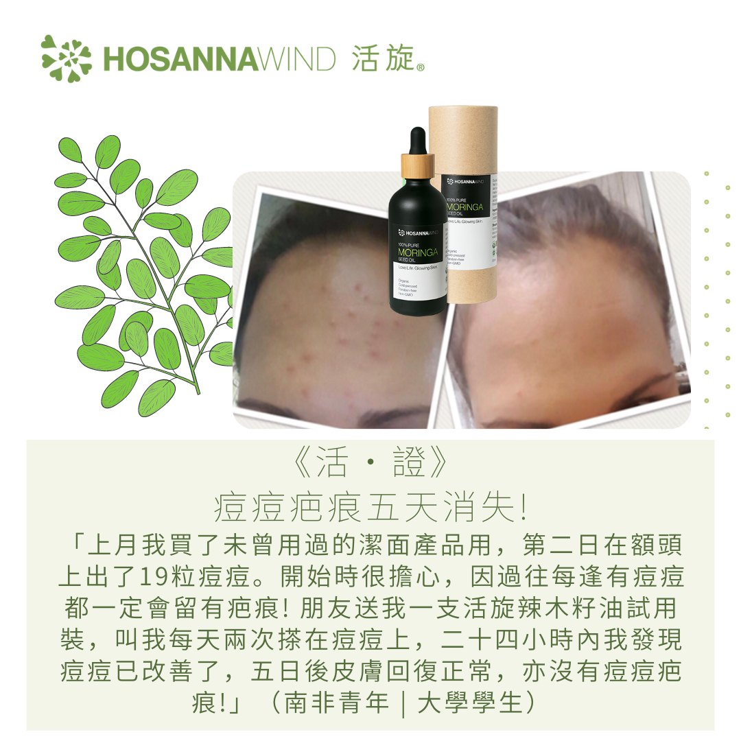 HOSANNAWIND MORINGA SEED OIL 3mL
