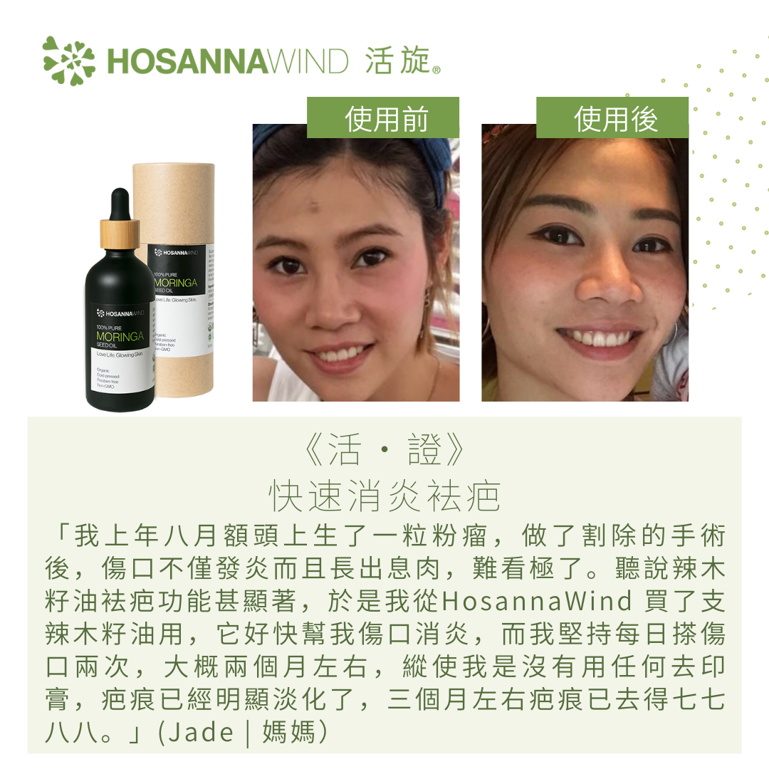 HOSANNAWIND MORINGA SEED OIL 3mL