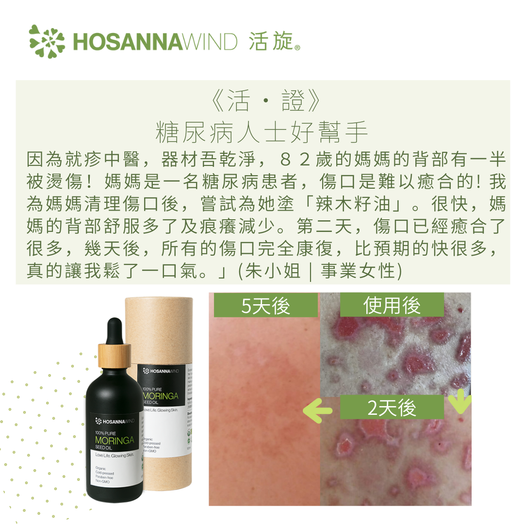 HOSANNAWIND MORINGA SEED OIL 3mL